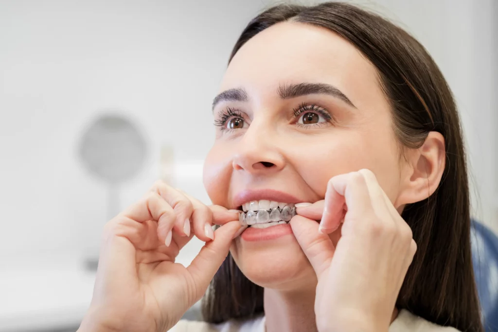 Aparat Invisalign® – efekty leczenia nakładkami