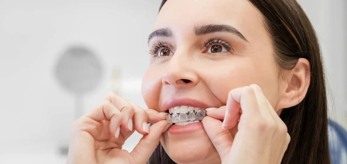 Kobieta z nakładkami Invisalign