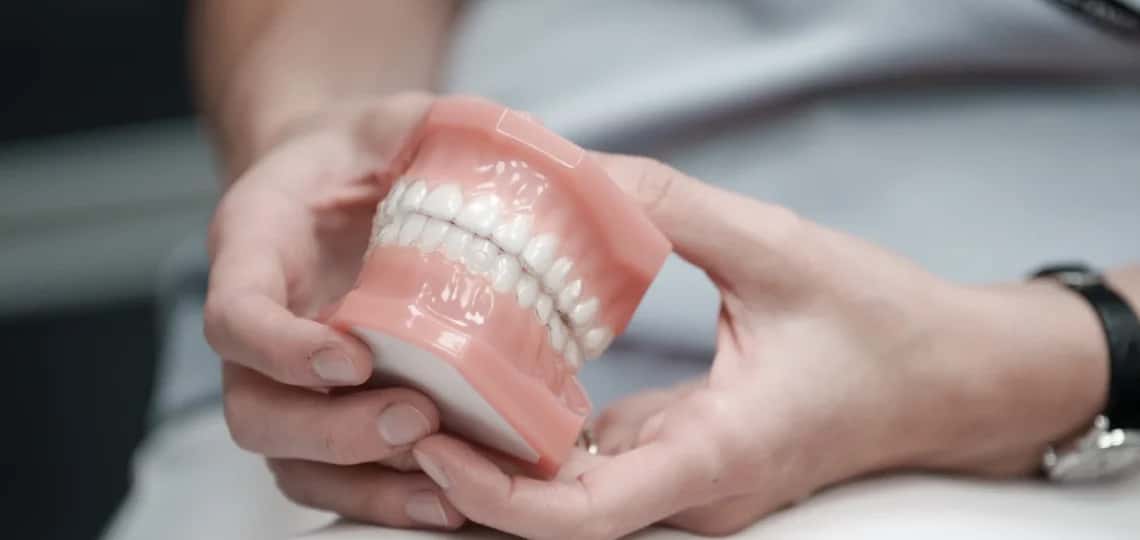 Idealny zgryz po leczeniu Invisalign