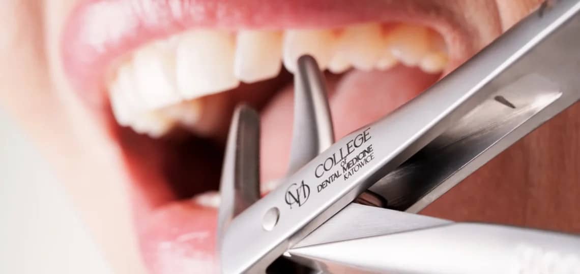 Wszczepienie implantu zębowego