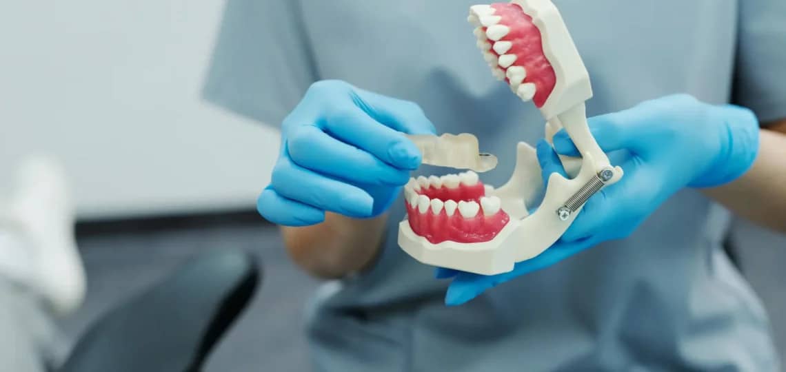 Przodozgryz na modelu dentystycznym