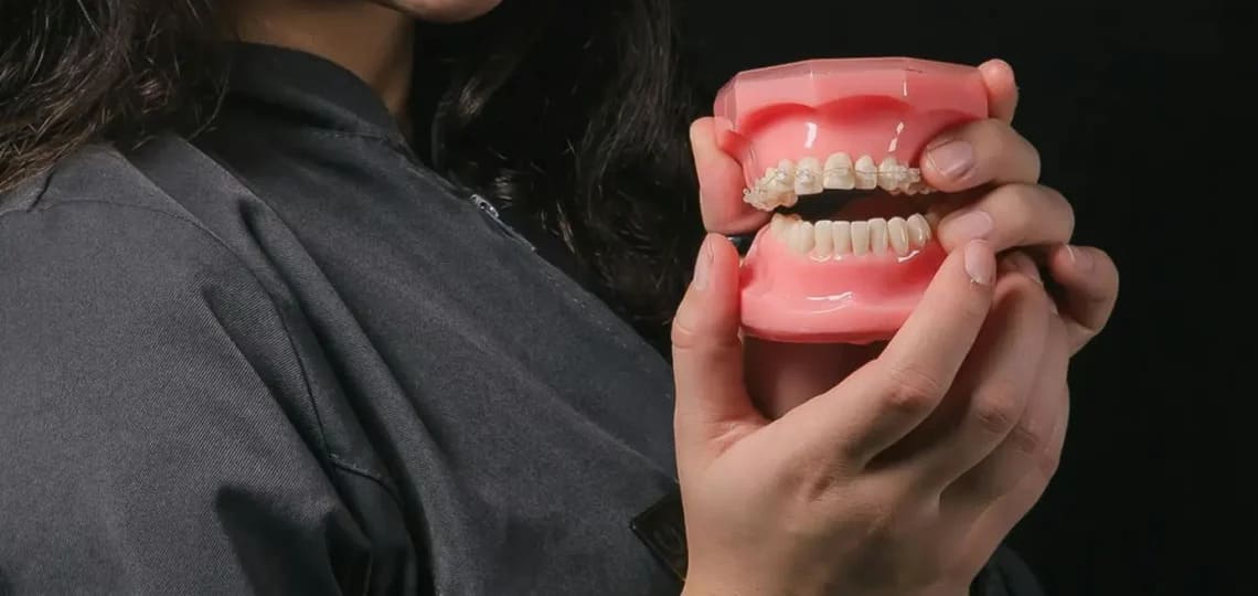 Zgryz otwarty na modelu dentystycznym